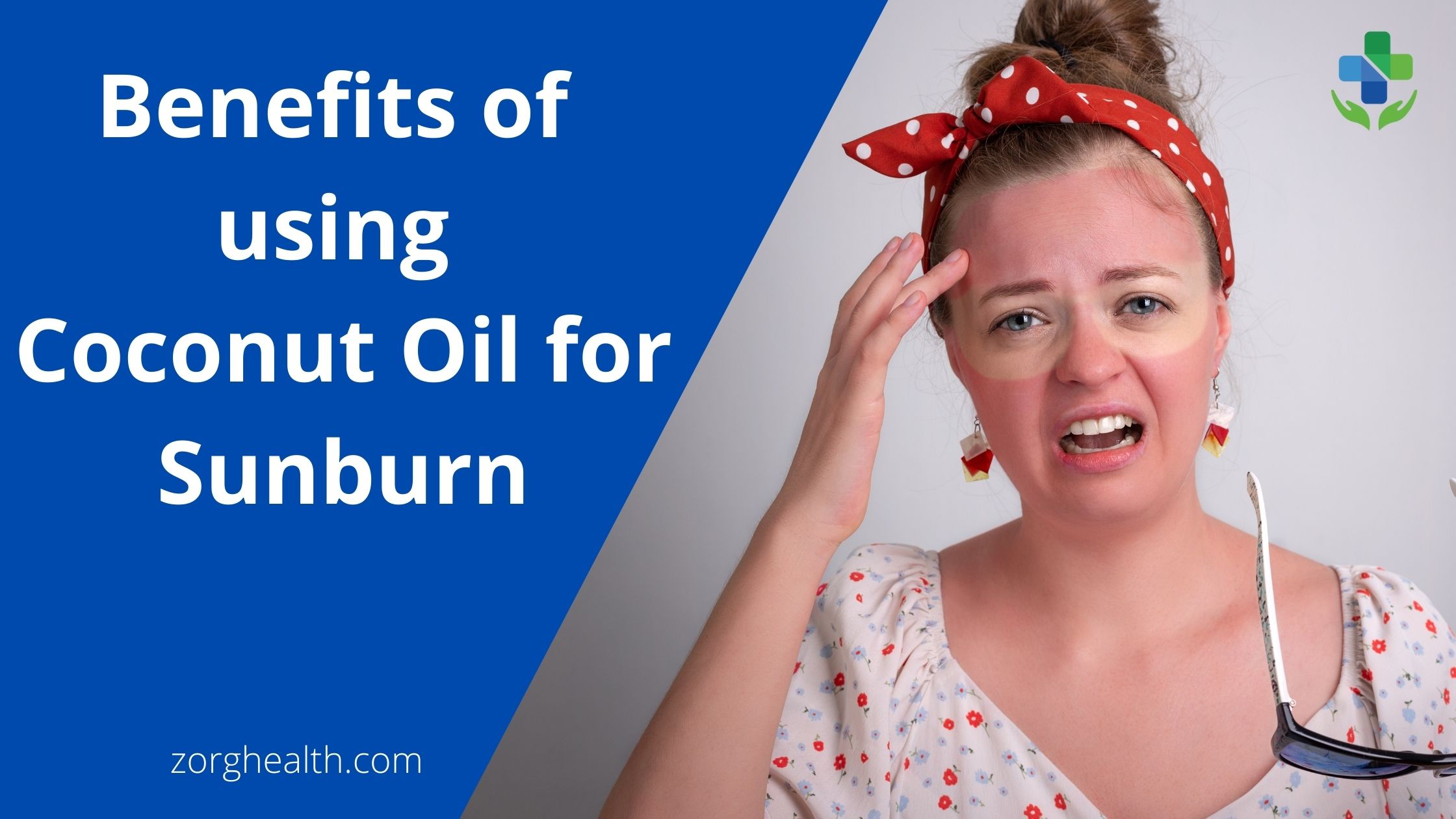 Coconut Oil for Sunburn