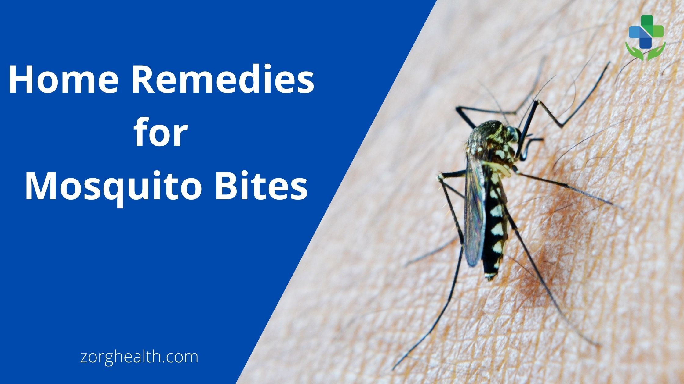 Home Remedies for Mosquito Bites