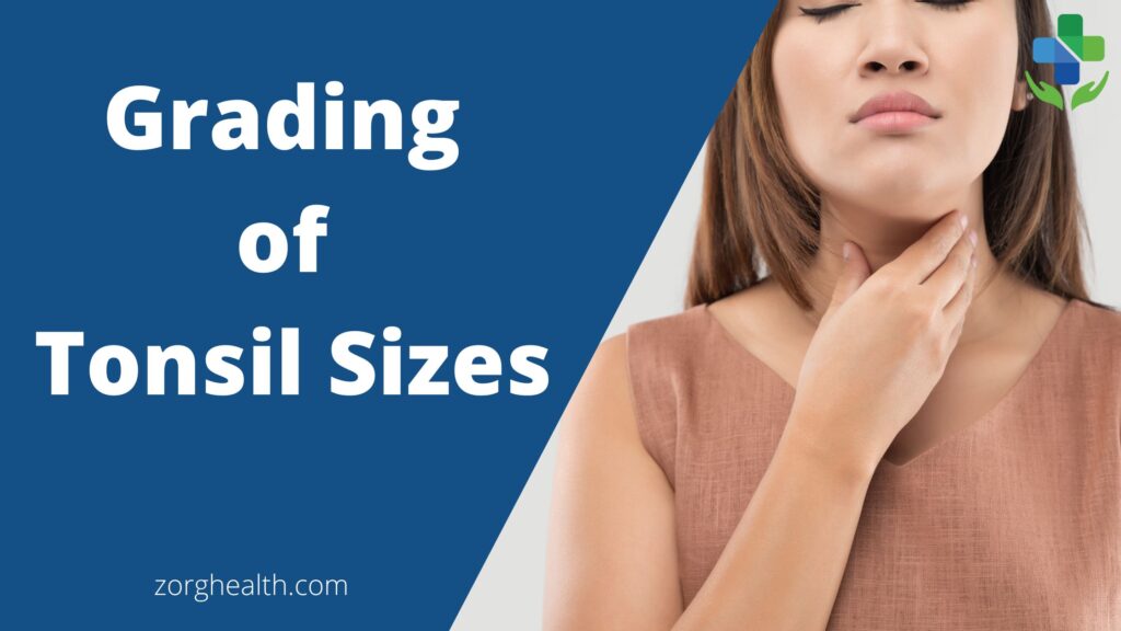 Decoding the Grading of Tonsil Sizes