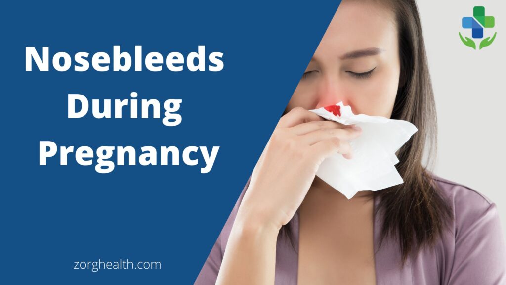 Nosebleeds during pregnancy