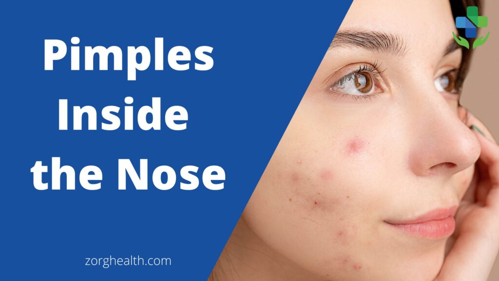Pimples Inside the Nose