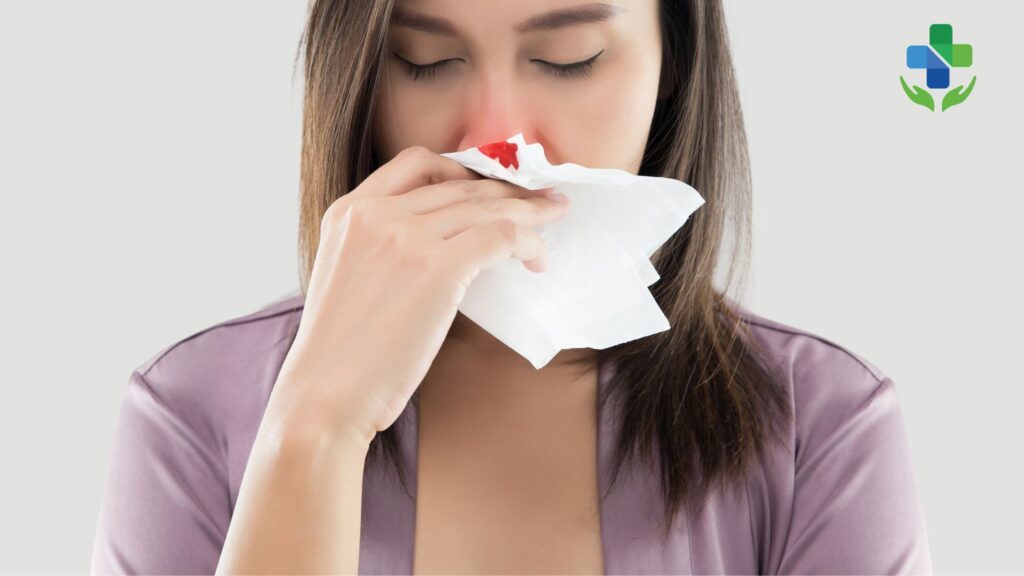 Managing Nosebleeds in Summer